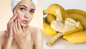 Banana-peel